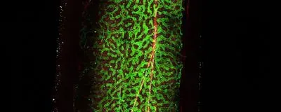 bone marrow exercise mouse osteolectin growth factor mechanical forces progenitors running exercise